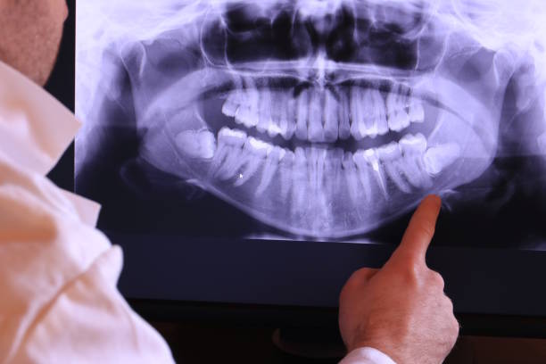Best Emergency Dentist for Knocked-Out Tooth in Narrows, VA
